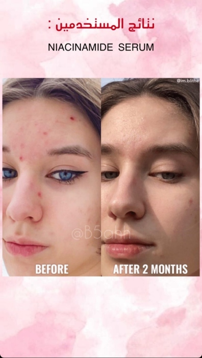 Good molecules, Niacinamide Serum